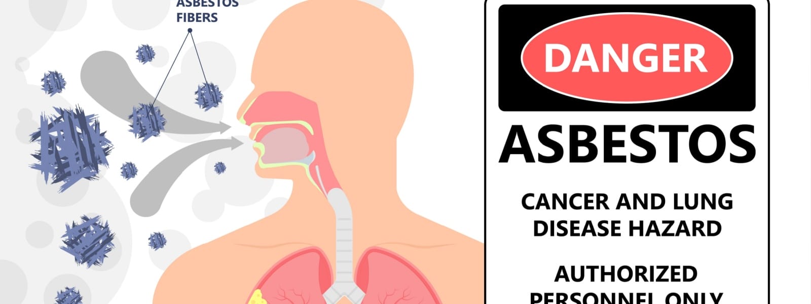 Asbestos Testing Morton IL 1 Asbestos Testing Morton IL